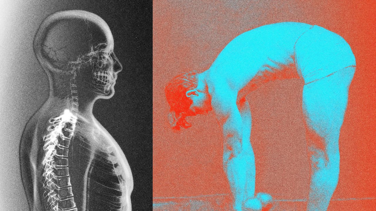 Top Back Exercises for Better Posture
