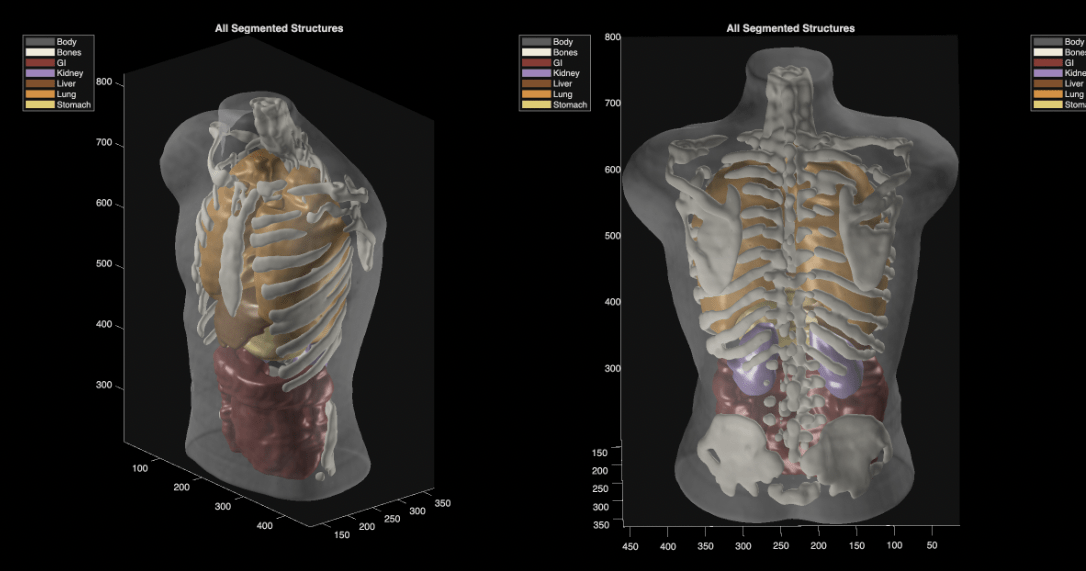Midjourney's Ultrasound Scanner Sparks Skepticism